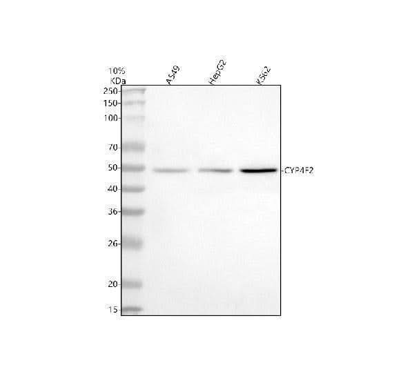 Anti-CYP4F2 Antibody Picoband® Boster Bio