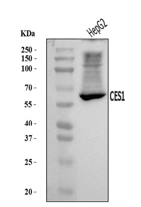 Anti-Liver Carboxylesterase 1/CES1 Antibody Picoband® Boster Bio