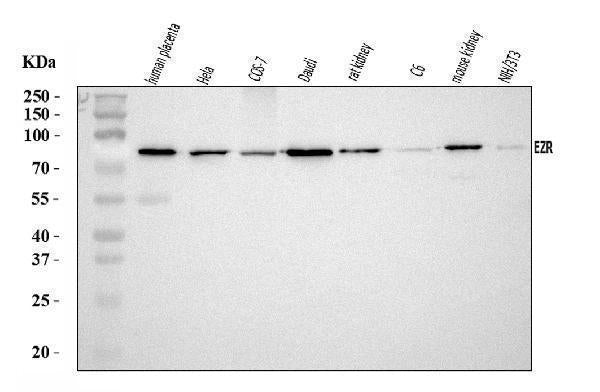 Anti-Ezrin/EZR Antibody Picoband® Boster Bio