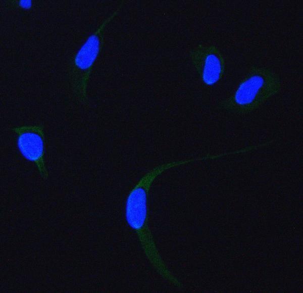 Anti-SDHA Antibody Picoband® Boster Bio