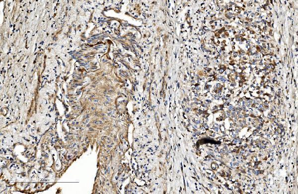 Anti-COL4A3 Antibody Boster Bio