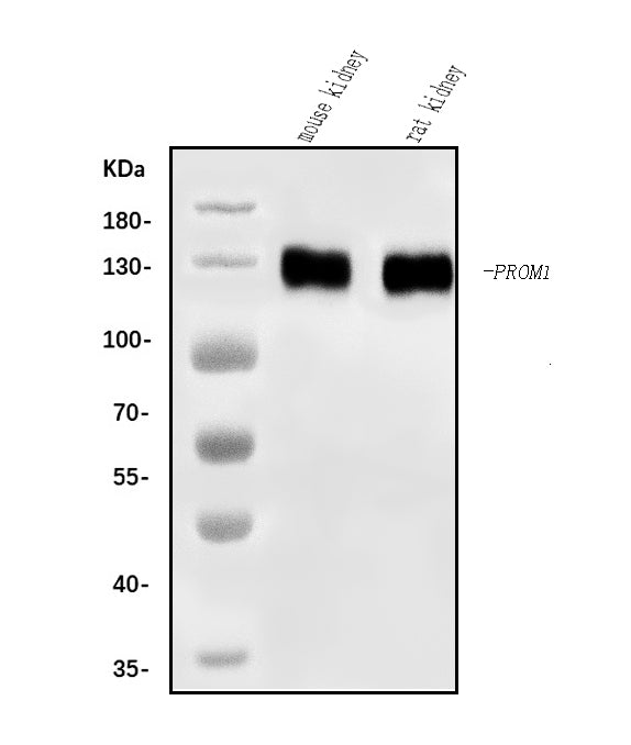 Anti-CD133/Prom1 Antibody Picoband® Boster Bio