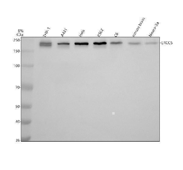 Anti-XPG/ERCC5 Antibody Picoband® Boster Bio