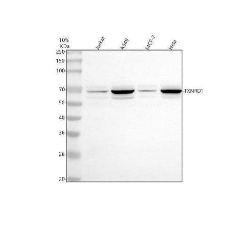 Anti-TXNRD1 Antibody Picoband® Boster Bio