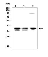 Anti-FDPS/FPS Picoband® Antibody Boster Bio