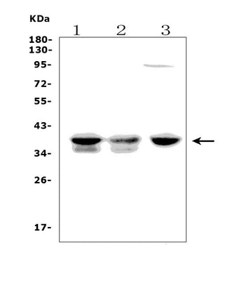 Anti-FDPS/FPS Picoband® Antibody Boster Bio