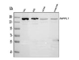 Anti-INPPL1 Antibody Picoband® Boster Bio