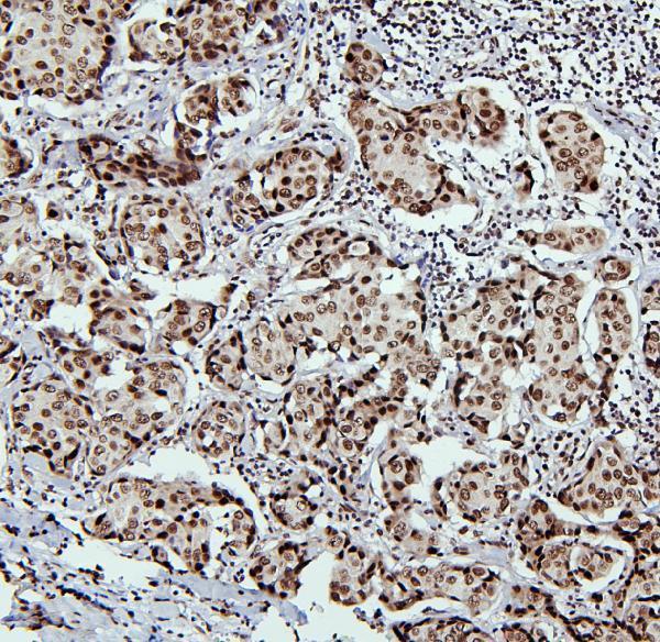 Anti-PTBP1 Antibody Picoband® Boster Bio