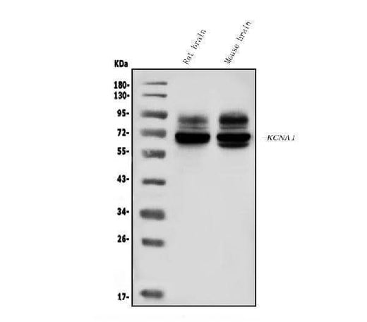 Anti-Kv1.1 potassium channel/KCNA1 Antibody Picoband® Boster Bio