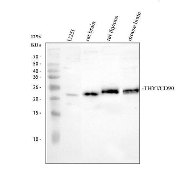Anti-CD90/Thy1 Antibody Picoband® Boster Bio