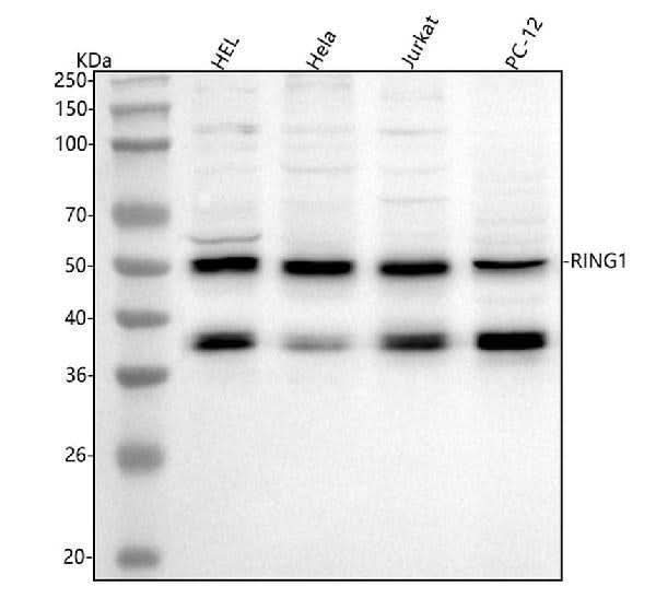 Anti-RING1 Antibody Picoband® Boster Bio
