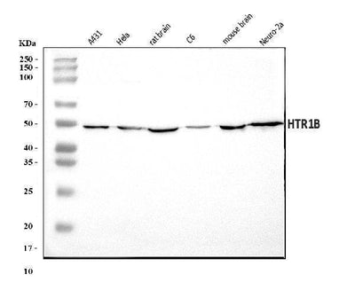Anti-5HT1B/HTR1B Antibody Picoband® Boster Bio