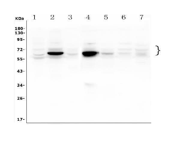 Anti-GLB1/Beta-galactosidase Antibody Picoband® Boster Bio