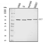 Anti-TRP2/DCT Antibody Picoband® Boster Bio