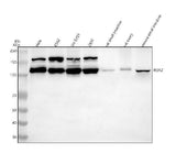 Anti-ROR2 Antibody Picoband® Boster Bio