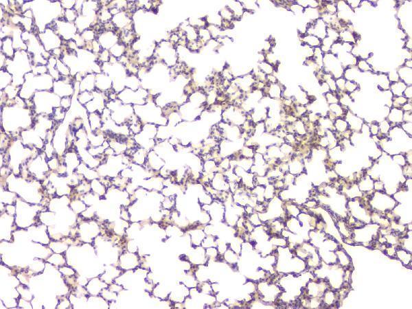 Anti-BMP15 Antibody Picoband® Boster Bio