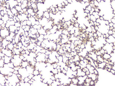 Anti-BMP15 Antibody Picoband® Boster Bio