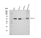 Anti-UGT1A1 Antibody Picoband® Boster Bio