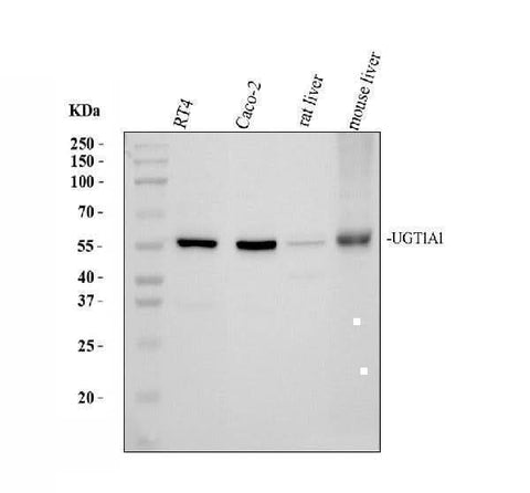 Anti-UGT1A1 Antibody Picoband® Boster Bio