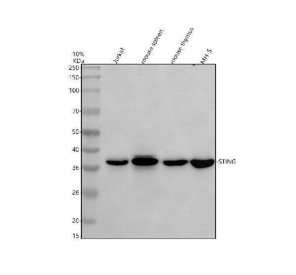 Anti-TMEM173/STING Antibody Picoband® Boster Bio