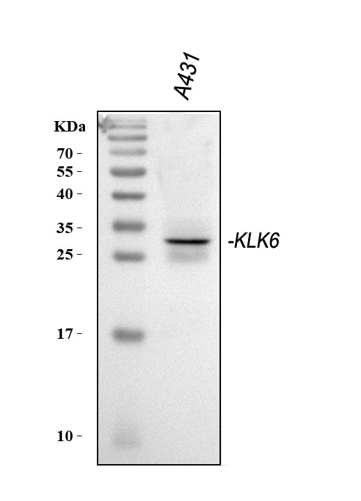 Anti-Kallikrein 6/KLK6 Antibody Picoband® Boster Bio