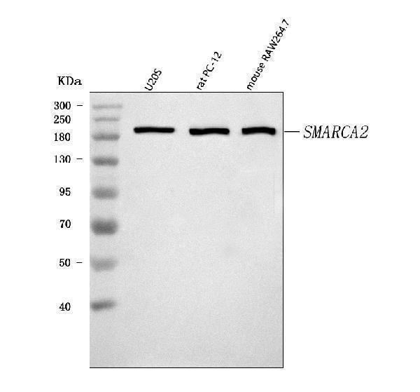 Anti-SMARCA2/BRM Antibody Picoband® Boster Bio
