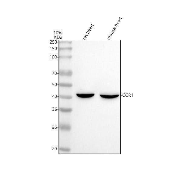 Anti-CCR1 Antibody Picoband® Boster Bio