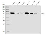 Anti-CAMKIV/Camk4 Antibody Picoband® Boster Bio