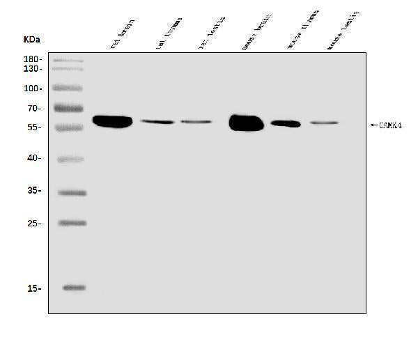 Anti-CAMKIV/Camk4 Antibody Picoband® Boster Bio