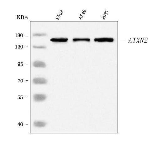 Anti-SCA2/ATXN2 Antibody Picoband® Boster Bio