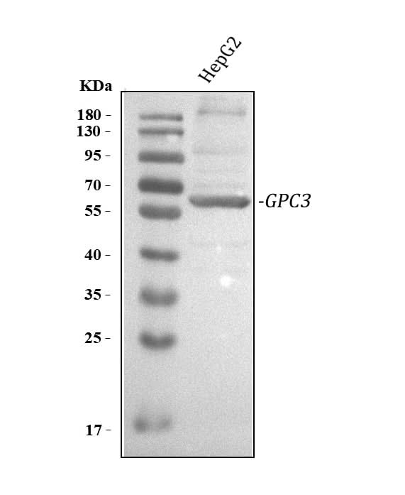 Anti-Glypican 3/GPC3 Antibody Picoband® Boster Bio