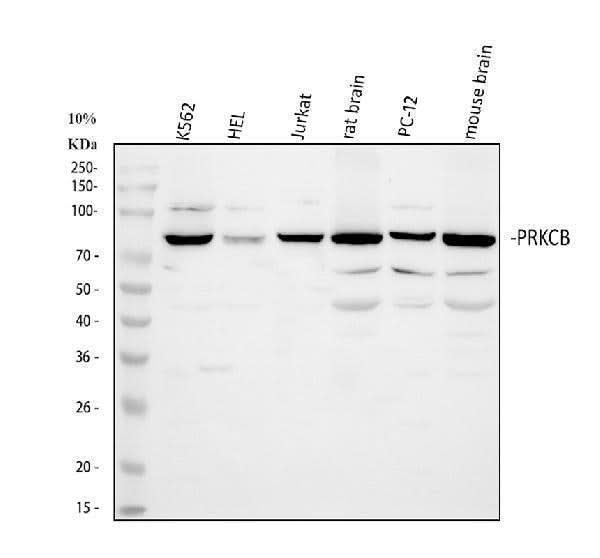 Anti-PKC beta 1/PRKCB Antibody Picoband® Boster Bio
