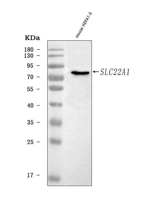 Anti-OCT1/Slc22a1 Antibody Picoband® Boster Bio