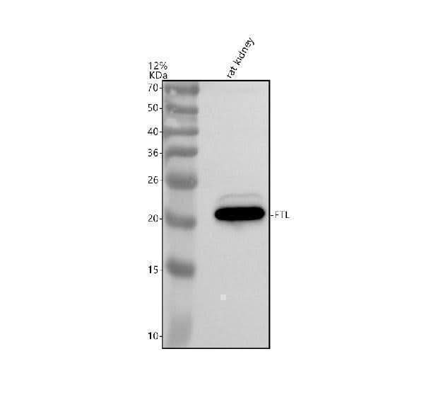 Anti-Ferritin light chain/FTL Antibody Picoband® Boster Bio