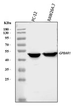 Anti-GPCR TGR5/GPBAR1 Antibody Picoband® Boster Bio