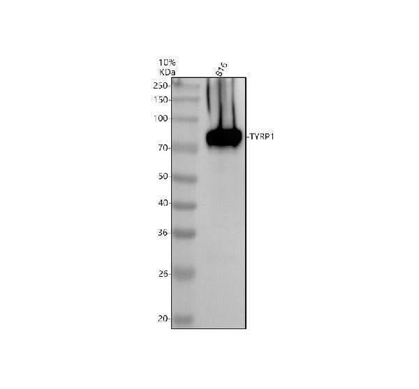 Anti-TYRP1 Antibody Picoband® Boster Bio