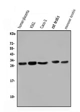 Anti-Lin28/LIN28A Antibody Picoband® Boster Bio