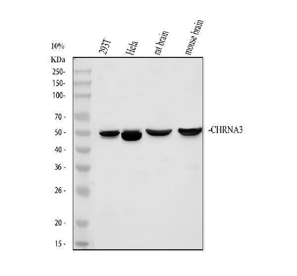 Anti-Nicotinic Acetylcholine Receptor alpha 3/CHRNA3 Antibody Picoband® Boster Bio