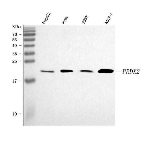 Anti-peroxiredoxin 2/PRDX2 Antibody Picoband® Boster Bio