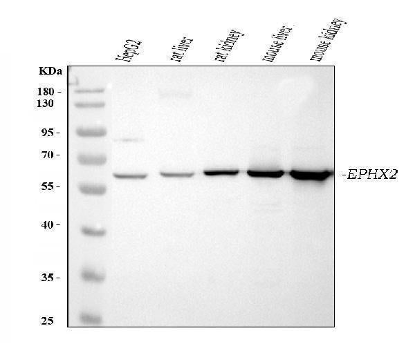 Anti-EPHX2 Antibody Picoband® Boster Bio