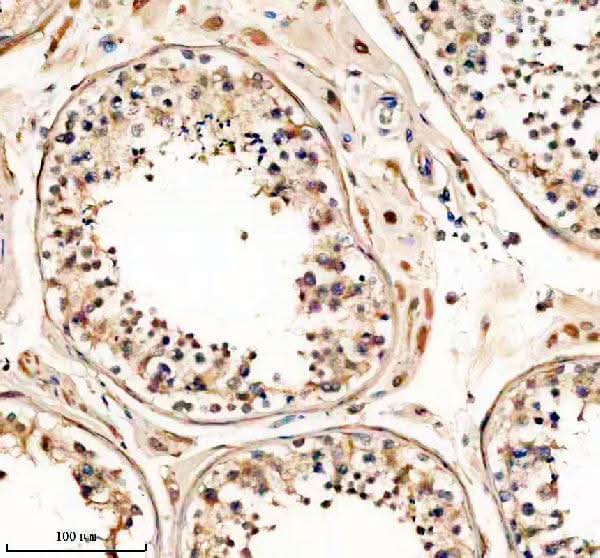 Anti-PTGDS Antibody Picoband® Boster Bio