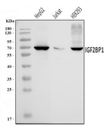 Anti-IMPI/IGF2BP1 Antibody Picoband® Boster Bio