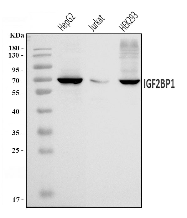 Anti-IMPI/IGF2BP1 Antibody Picoband® Boster Bio
