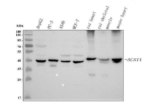 Anti-ACAT1 Antibody Picoband® Boster Bio
