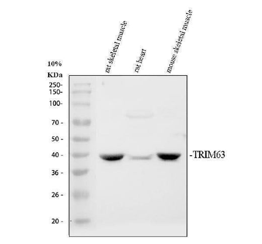 Anti-MURF1/TRIM63 Antibody Picoband® Boster Bio