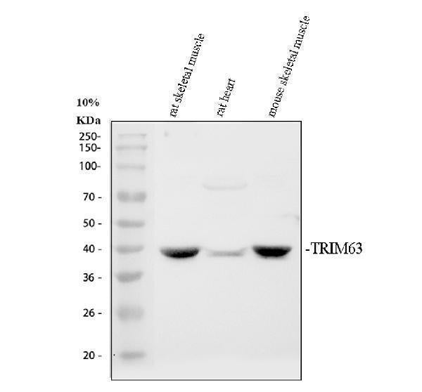 Anti-MURF1/TRIM63 Antibody Picoband® Boster Bio