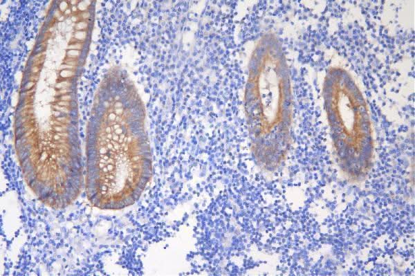 Anti-Desmoglein 2/DSG2 Antibody Picoband® Boster Bio