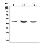 Anti-ASAH1 Picoband® Antibody Boster Bio
