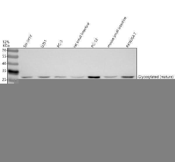 Anti-IL17F Antibody Picoband® Boster Bio