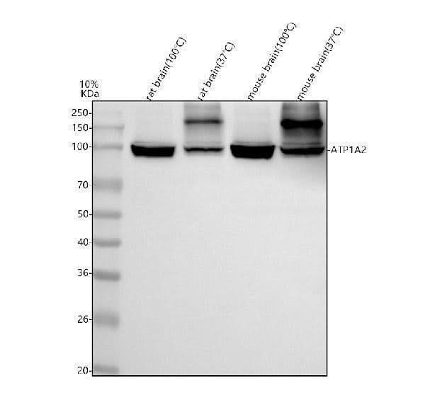 Anti-ATP1A2 Antibody Picoband® Boster Bio